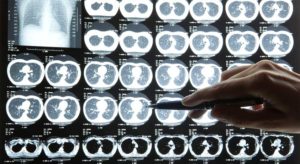 5 of the Most Overlooked Topics on the Radiology Board Review 5 of the Most Overlooked Topics on the Radiology Board Review