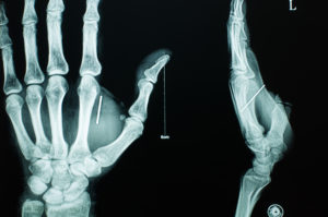 Free ARRT Exam Questions for Radiography Certification Free ARRT Exam Questions for Radiography Certification