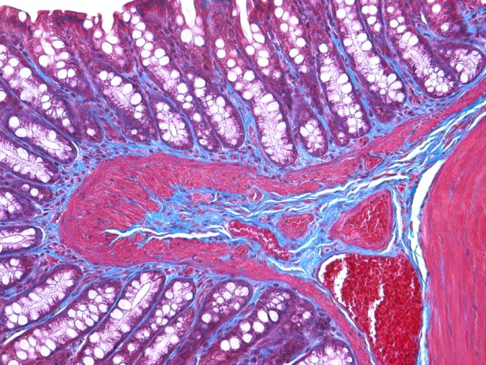 So You Want To Be A Pathologist… So You Want To Be A Pathologist…