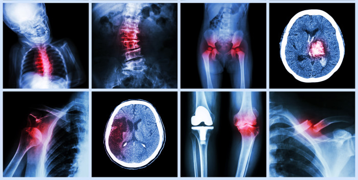See the Big Picture: 5 Free COMLEX Sample Questions See the Big Picture: 5 Free COMLEX Sample Questions