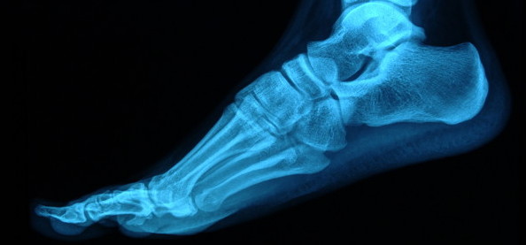 Get Started on the Right Foot with 6 Free Foot Surgery Questions Get Started on the Right Foot with 6 Free Foot Surgery Questions