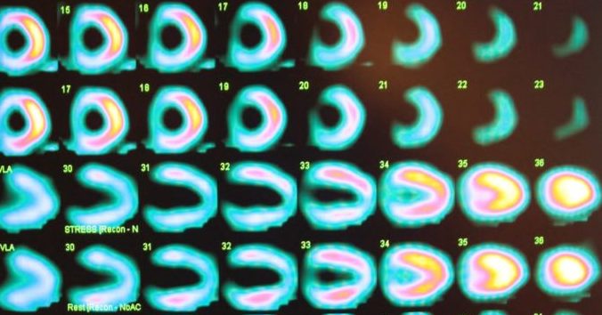 5 Informative Books for the Nuclear Cardiology Boards 5 Informative Books for the Nuclear Cardiology Boards