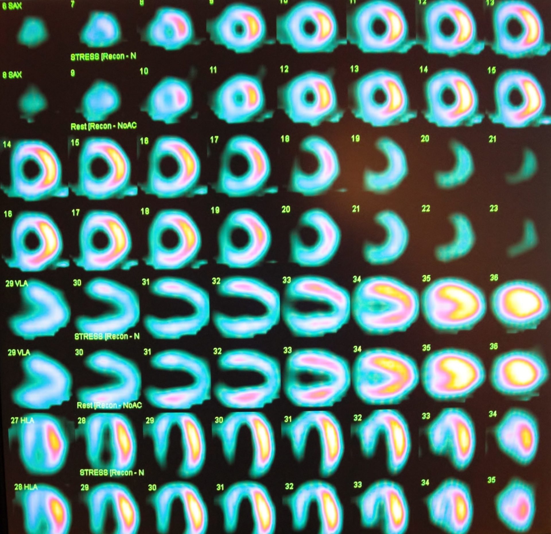 5 Informative Books for the Nuclear Cardiology Boards 5 Informative Books for the Nuclear Cardiology Boards