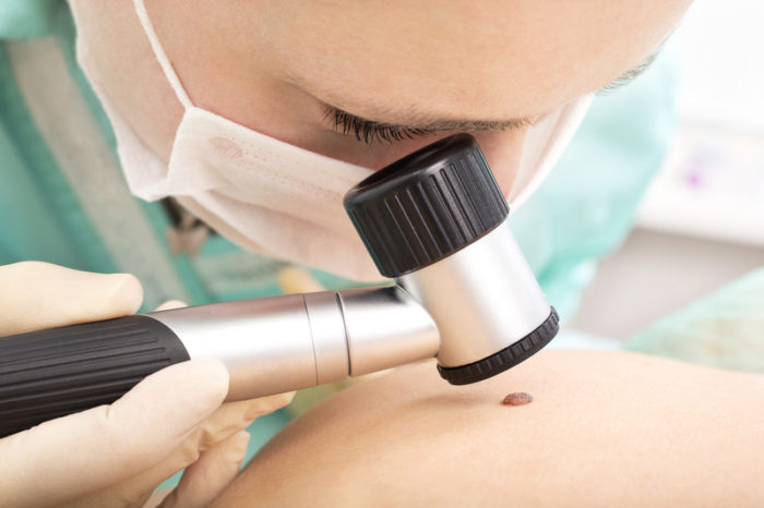 Whack a Mole with 6 Free Dermatology Sample Questions Whack a Mole with 6 Free Dermatology Sample Questions