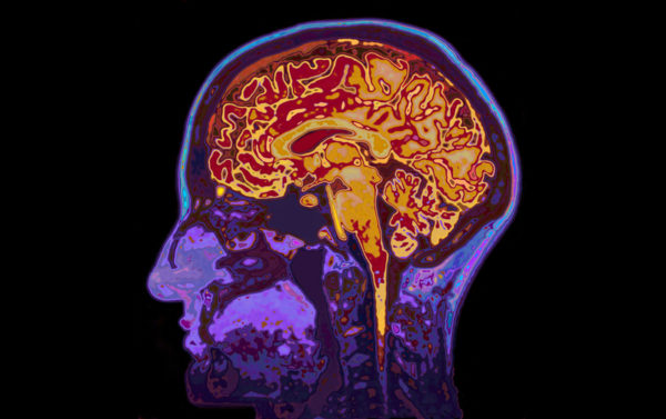 Think You Can Answer These 6 Psychiatry Board Exam Questions? Think You Can Answer These 6 Psychiatry Board Exam Questions?