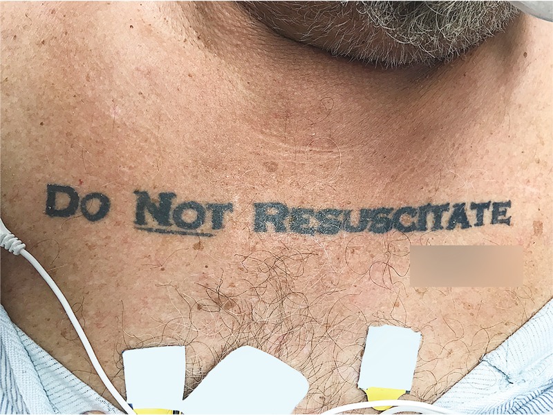 Do Not Resuscitate Tattoos